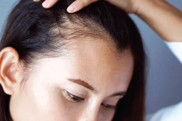 What Supplements Help With Hair Loss? 3 Key Benefits, 8 Essential Nutrients, and 6 Common Causes Explained