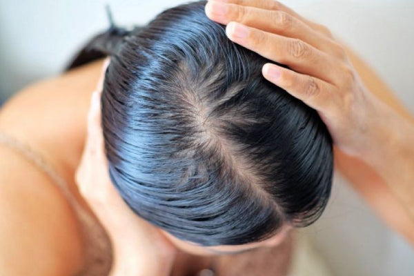 How Much Hair Loss is Normal Daily? | Hair Growth Methods | BaiZiGui
