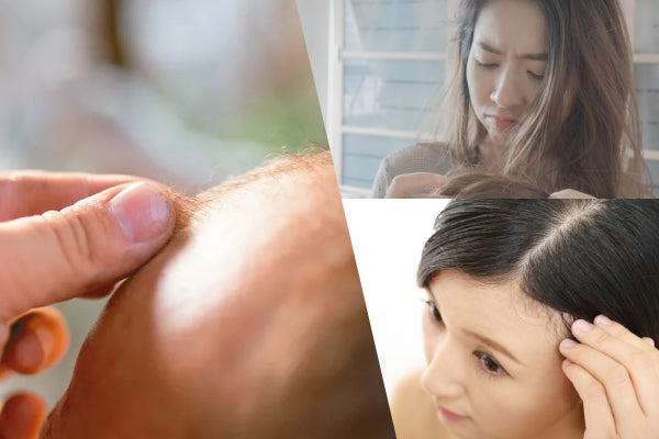 Want to Grow Hair? Effective Methods Matter | BaiZiGui