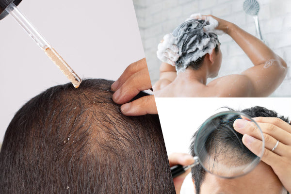 Comprehensive Guide to Hair Growth Products: Types, Benefits, and Choosing the Right Solution
