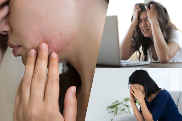The Effects of Hormonal Imbalance: From Emotional to Physical Changes and Traditional Chinese Medicine (TCM) Remedies