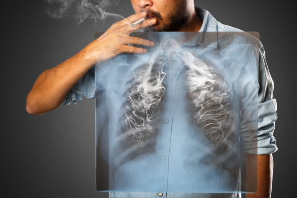 Best Lung Health Supplements for Smokers: Effective Ways to Detox and Restore Lung Function