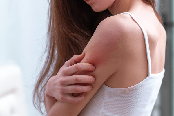 Is Sensitive Skin Related to a Damp-Heat Constitution? How to Regulate It | Baizigui's Recommended Solutions