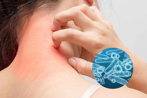 How to Fix Sensitive Skin: 5 Supplements to Support Your Skin from Within and Eliminate Redness and Itching