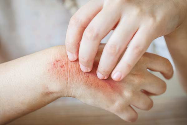 Sensitive Skin Flares Up Again and Again? Discover the Real Causes and Effective Solutions