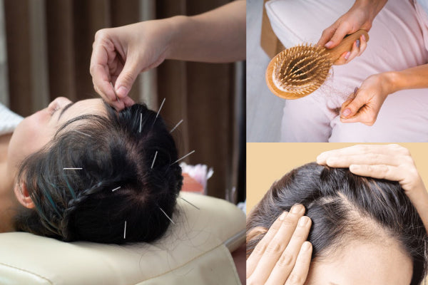 Traditional Chinese Medicine Acupuncture for Hair Growth: A Natural Solution to Hair Loss