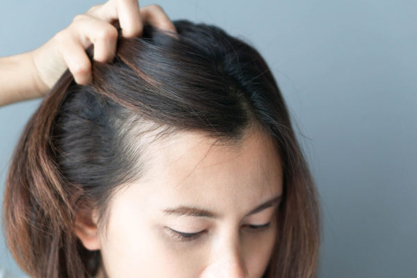 What to Do About Female Baldness? A Complete Breakdown of Stress, Hormones, and Hair Loss