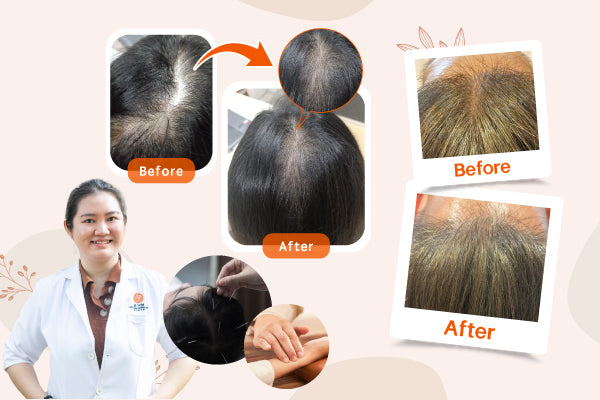 Complete TCM Guide to Hair Loss Regulation: Fundamentally Improve Thinning Hair and Scalp Health