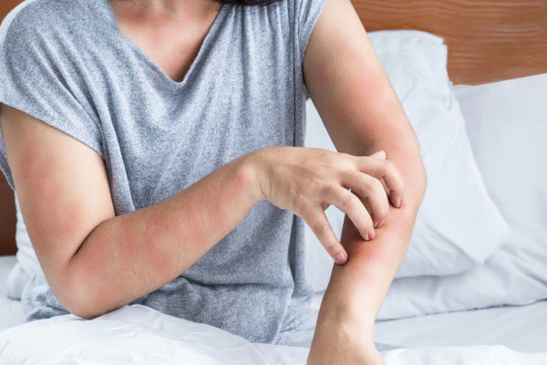 Why Does Your Skin Itch More at Night? A Deep Dive into Skin Sensitivity and Nocturnal Barrier Repair