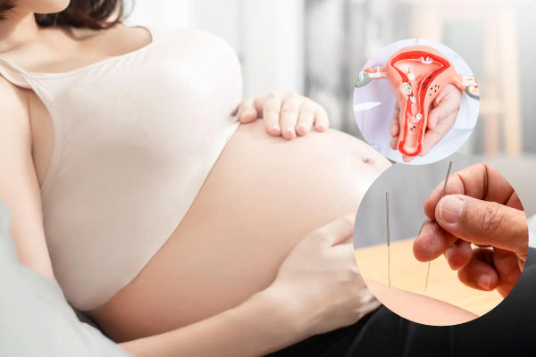 PCOS is Not the End: A Holistic 90-Day TCM Strategy for Fertility