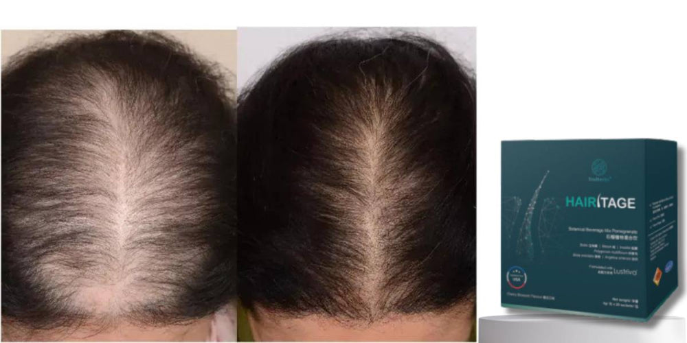 Want to Solve Hair Loss? This Is What You Should Use! - Bai Zi Gui