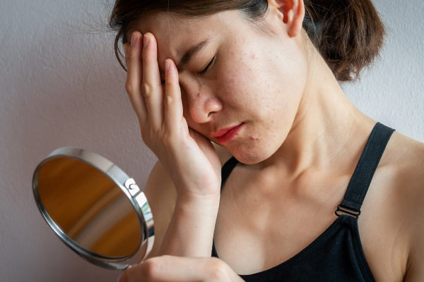 The Invisible Conductor of Your Body: Why Hormone Imbalance Leaves You Exhausted
