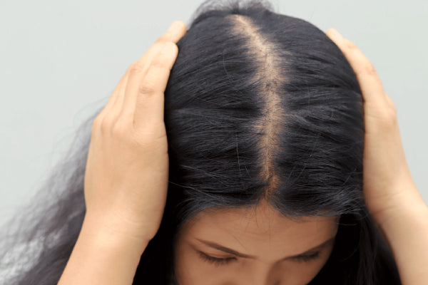 Stop Your Hairline from Becoming a Sign of Aging: The 10 Hidden Culprits of Hair Loss and Your Guide to Recovery
