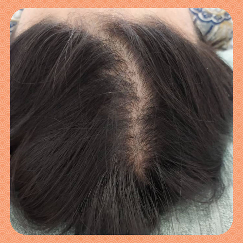 After - From Insecure to Confident: Ms. V’s Journey to Thicker, Healthier Hair