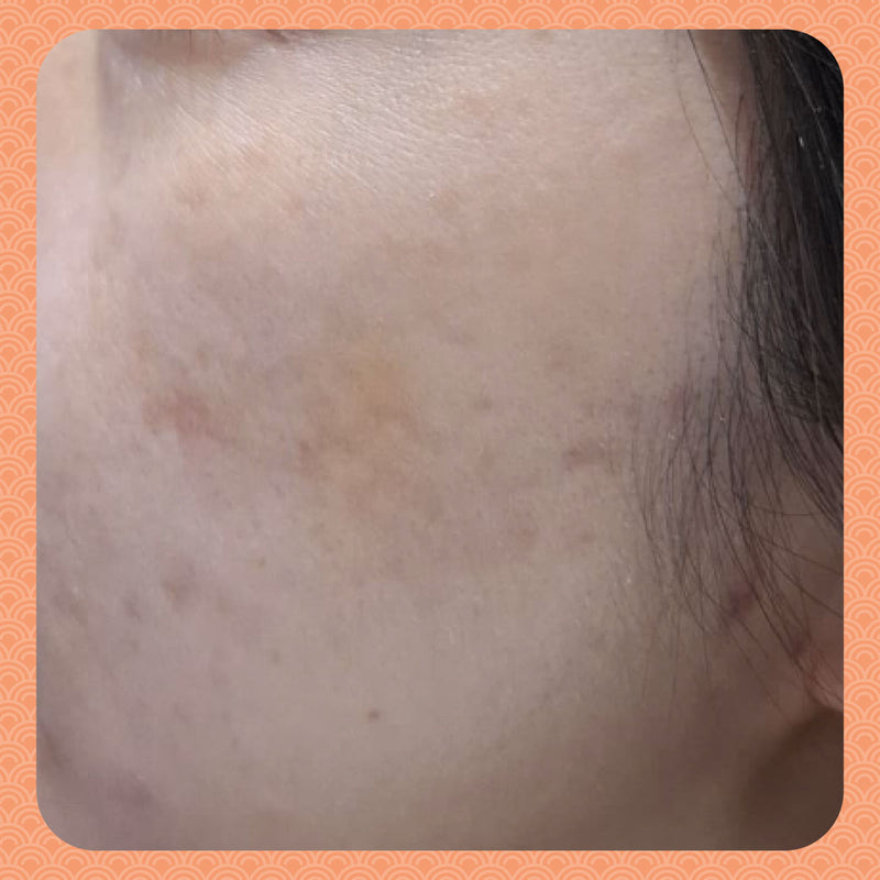 After - Ditching the Creams: How Ms. K Brightened Her Complexion a Whole Shade Lighter