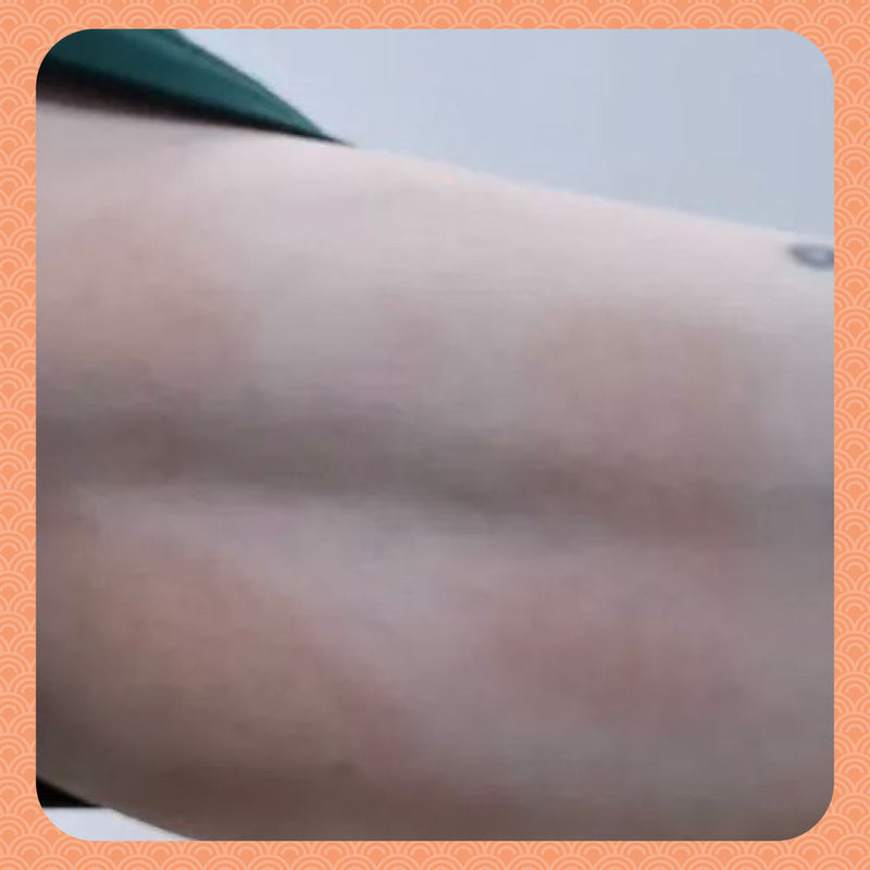 After - Clear Skin in 1 Week: How Rebalancing My Body Stopped My Eczema Flare-Ups